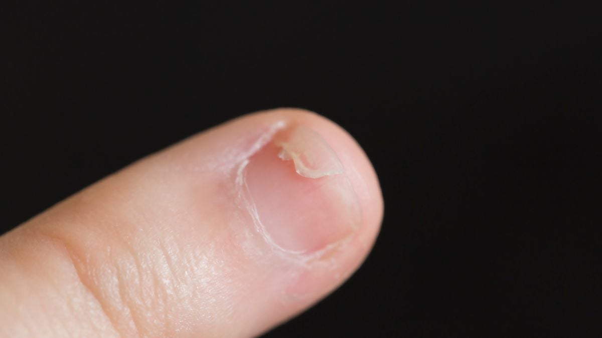 Fingernail