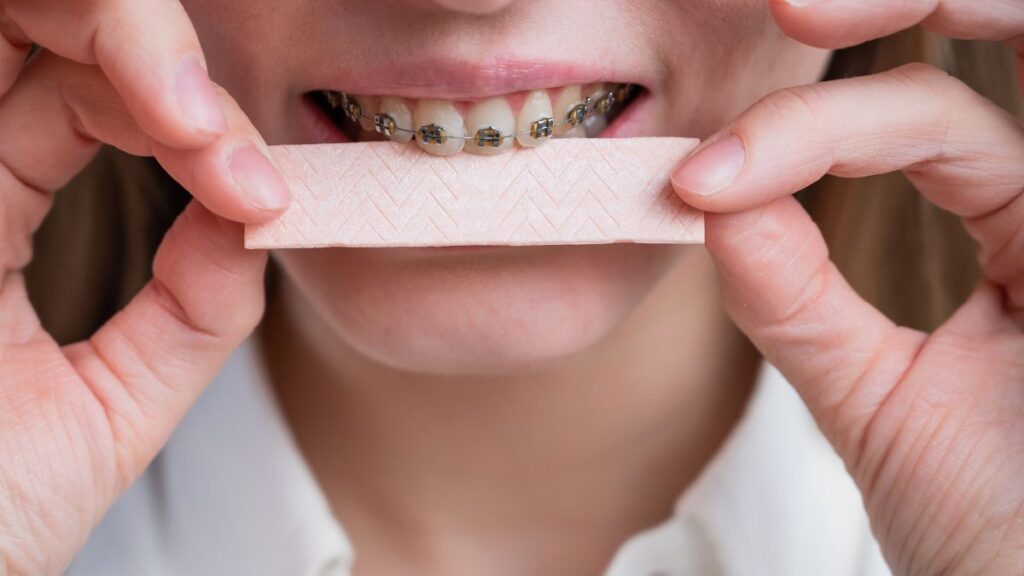 Eating Gum With Braces What will Happen?