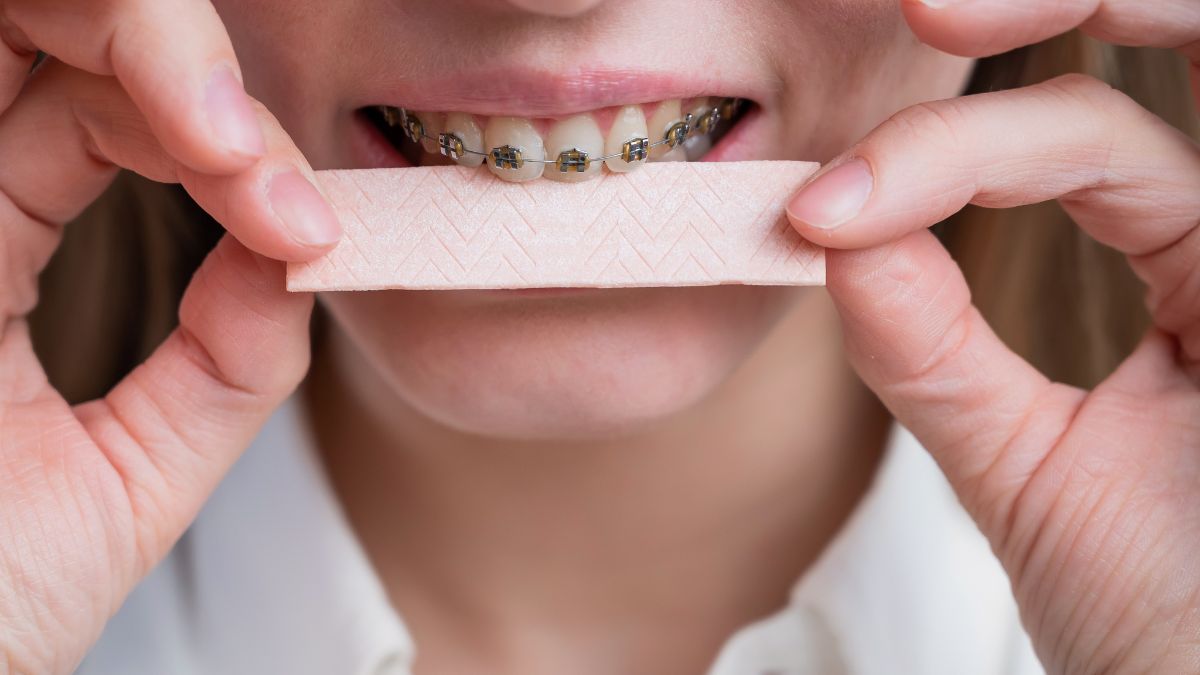 Gum